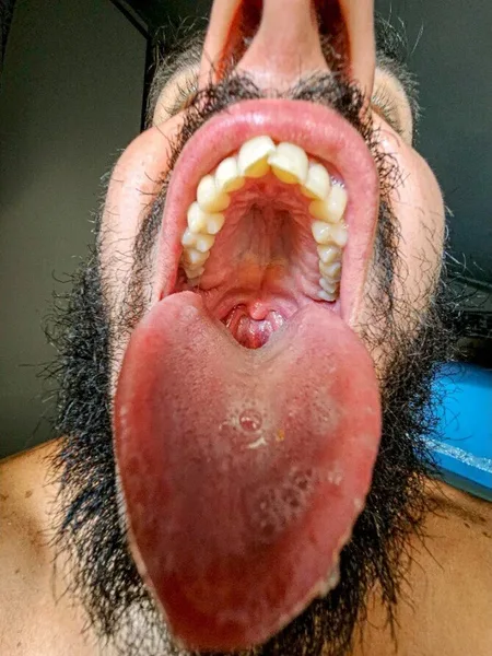 AlexanderVenom