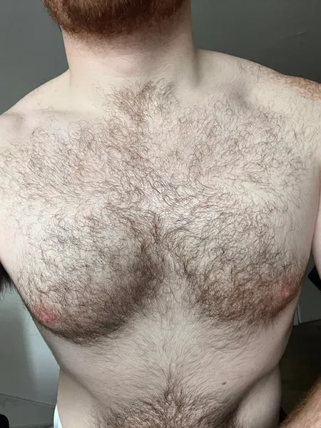 Al