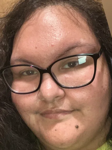 ChubbyFox