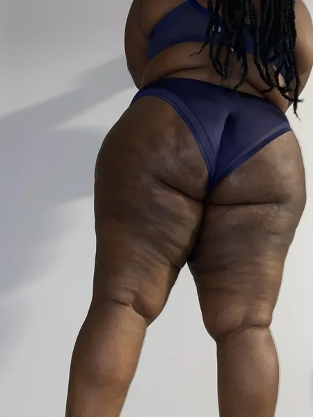 Noni Dark