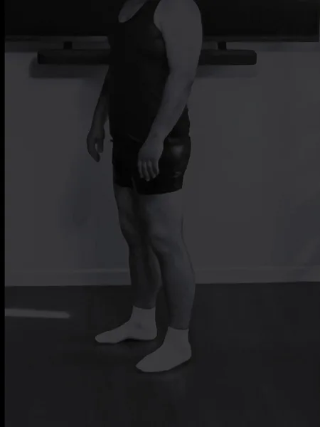 DDEYP
