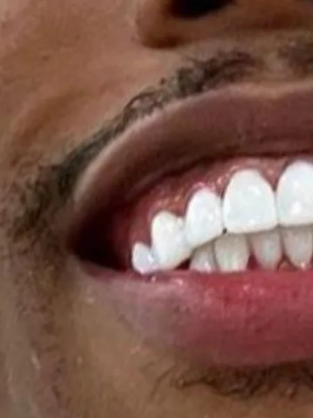 GreatestSmileEver