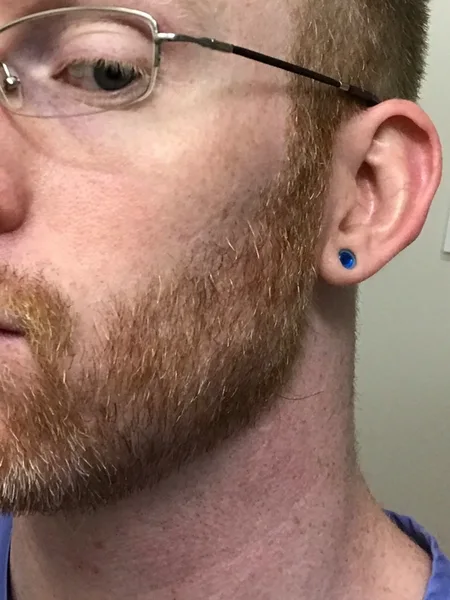 EdgeGinger