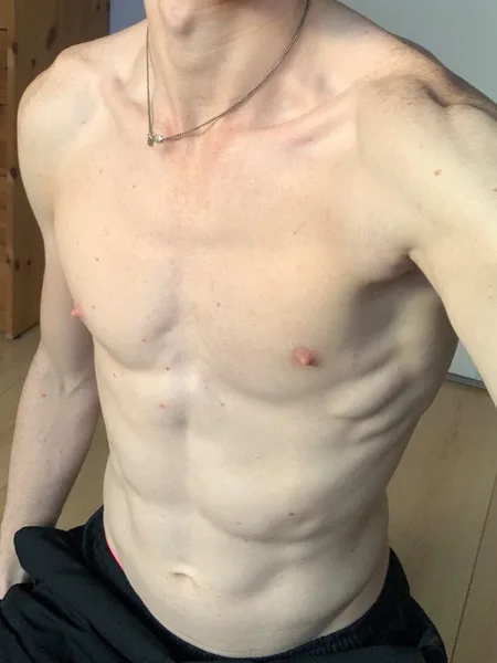 Fabian Phoenix