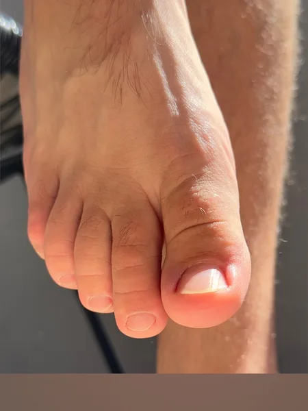 Leo🦶🏻