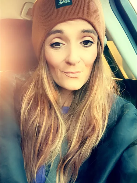 Freckles