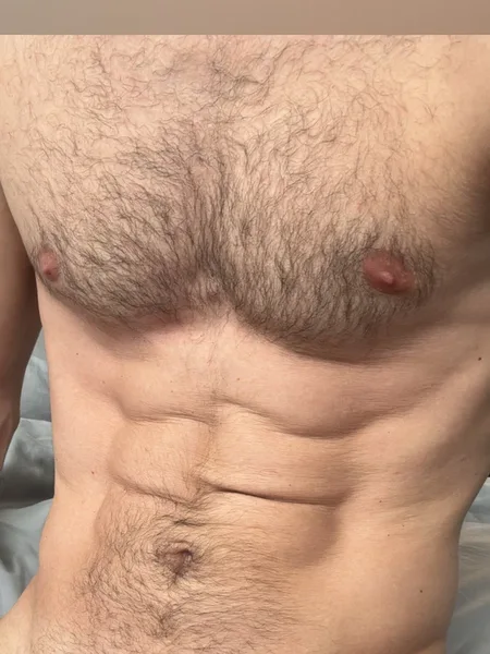 fuzzytwunk