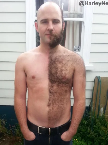 Hairy Navel
