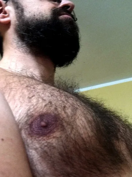 Hairy Teddy 🐻 VIP