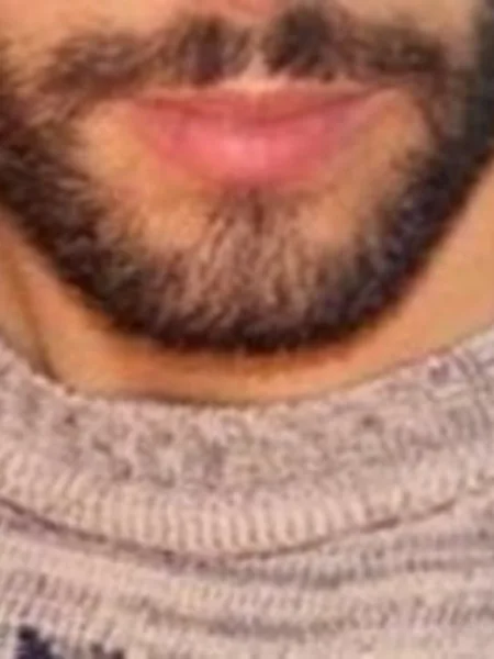 C*MDUMP BEARD