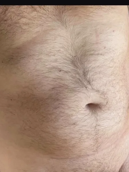 TheHungFred