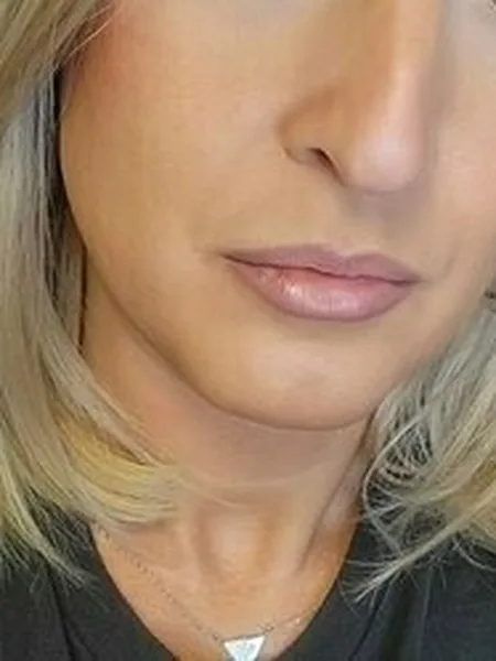 Kris Kurves