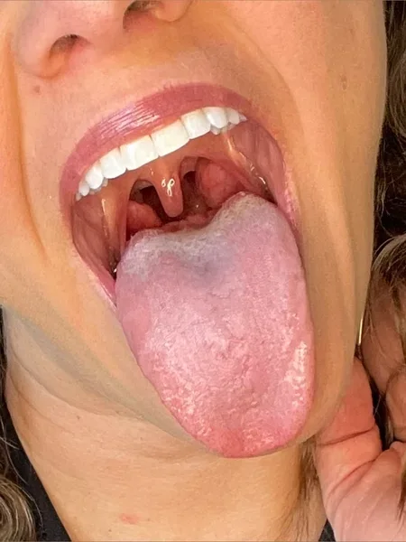 Aubrey Chase