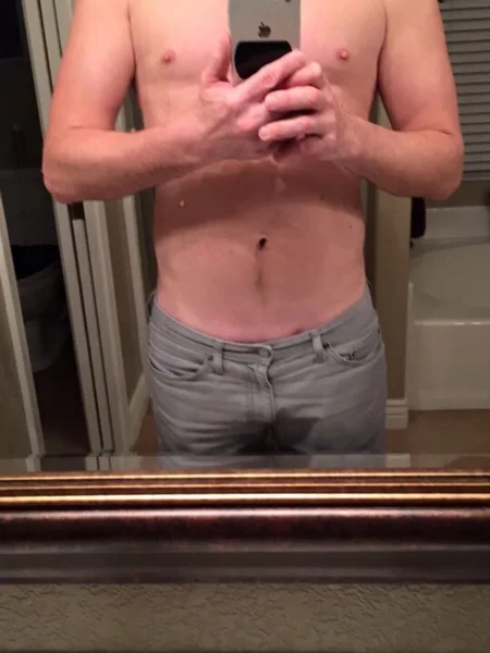 MT