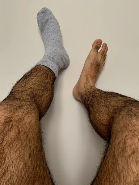 My Hairy Legs