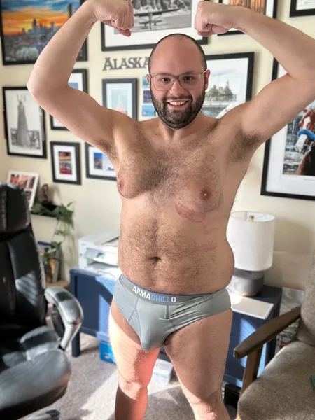 Nick