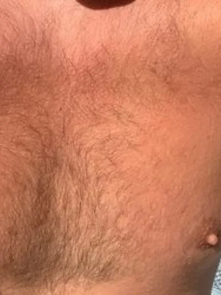Nudiststrokin