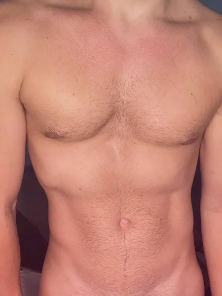 Prostate Papi