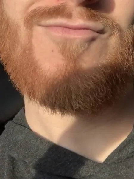 rimmingbubble