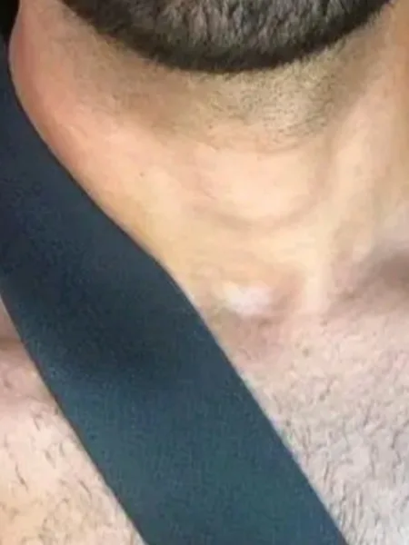 Sex on the Street