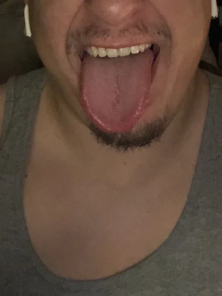 Mark