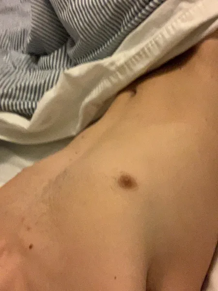 T