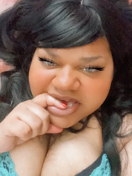 Suga 💋