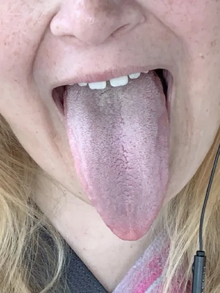 Talon TongueThroatLove