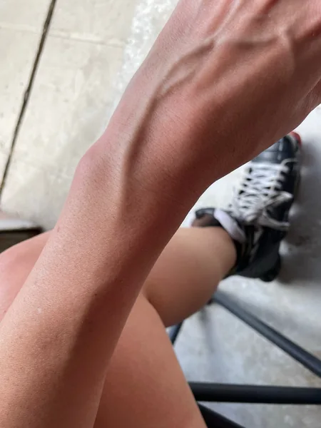 Vein Girl
