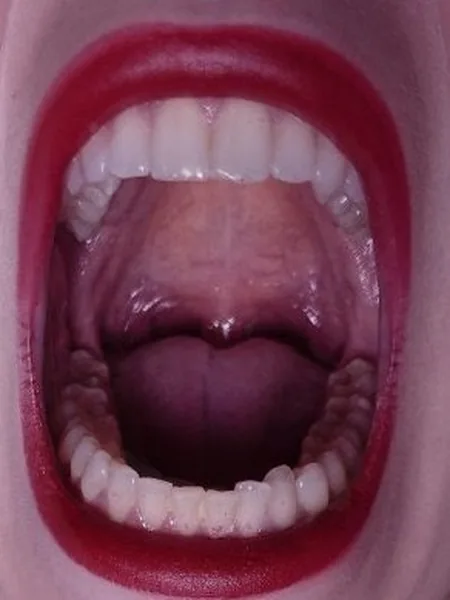 Vore-acious